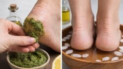 Safe Kitchen Ingredients Help Heal Dry Cracked Heels Faster Than Expected